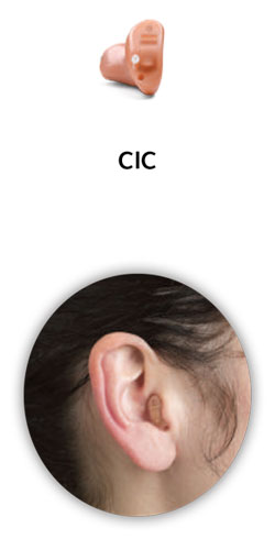 Audífono de Resound intracanal CIC y su muestra en oido real.